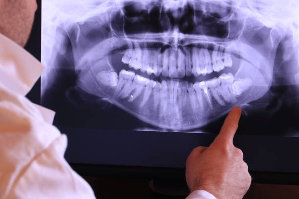 Best Emergency Treatment for Toothache in Santo Domingo Pueblo, NM